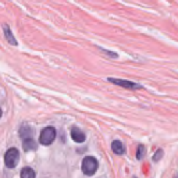 H&E histopathology patch