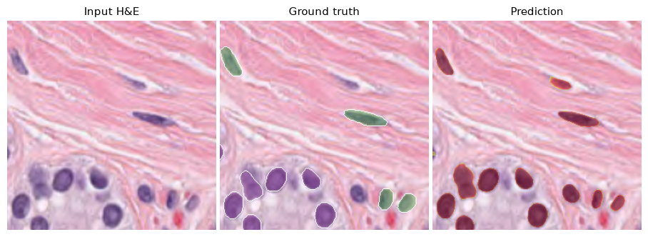 Cell nucleus segmentation panel