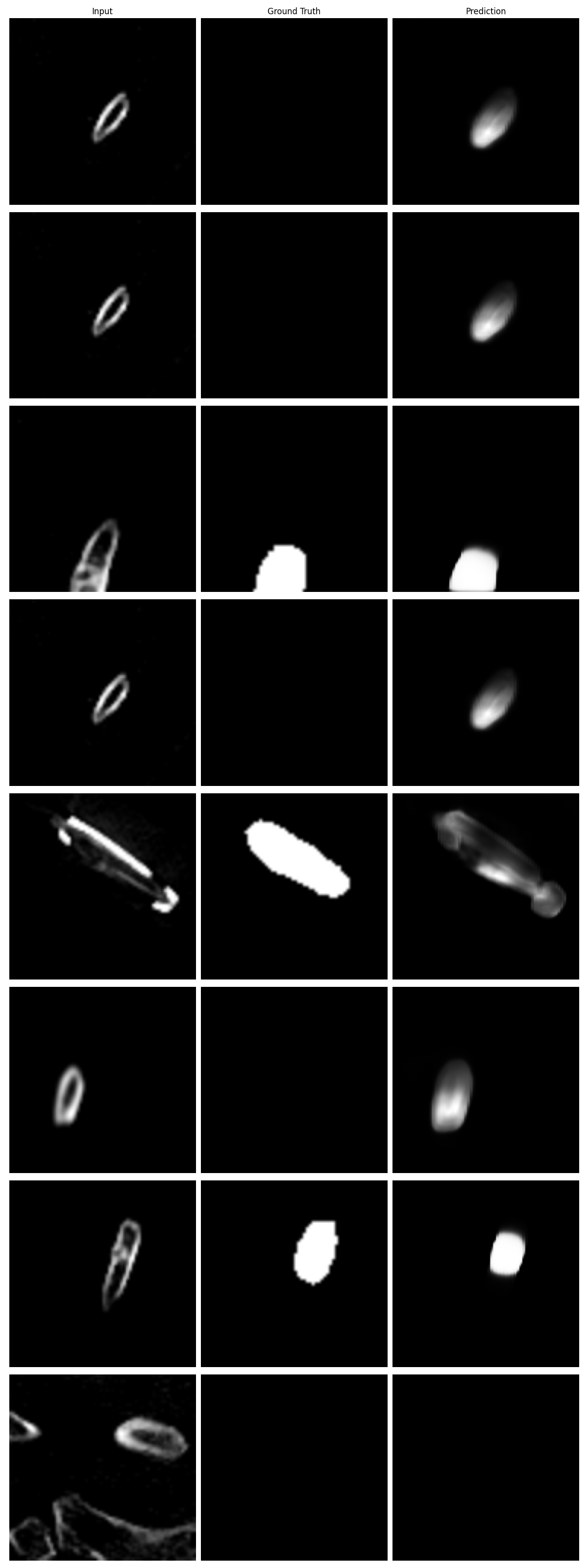 AI4Med Ribfrac Visualization